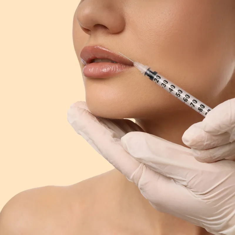 Preenchimento Labial